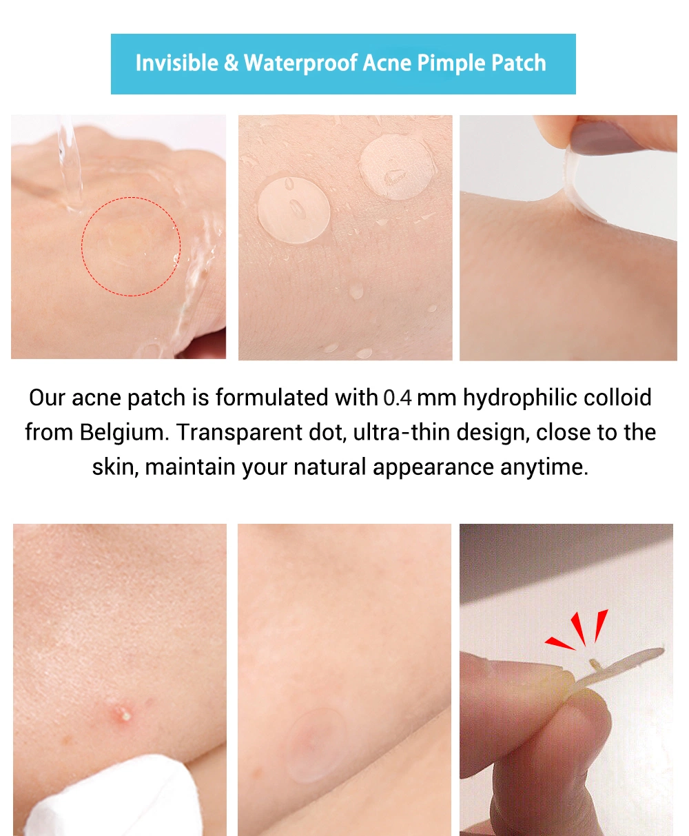 Hydrocolloid Acne Patch with Colorful Shapes From Chinese Manufacturer